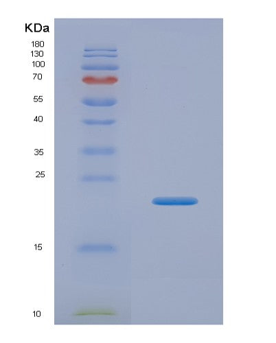 SDS-PAGE analysis of Human IL1A (Interleukin-1 Alpha) - Recombinant Protein, CATHuman IL1A (Interleukin-1 Alpha) - Recombinant Protein