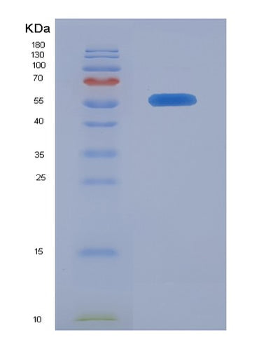SDS-PAGE analysis of Human IL10RA (Interleukin-10 Receptor Subunit Alpha) - Recombinant Protein, CAT# BLT-07881P, showing >90% purity under 15% SDS-PAGE (Reduced)Human IL10RA (Interleukin-10 Receptor Subunit Alpha) - Recombinant Protein