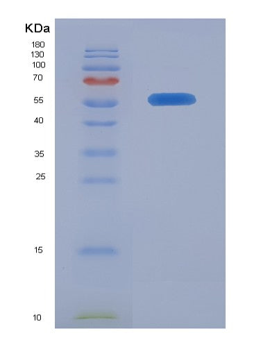 SDS-PAGE analysis of Human IL10RA (Interleukin-10 Receptor Subunit Alpha) - Recombinant Protein, CATHuman IL10RA (Interleukin-10 Receptor Subunit Alpha) - Recombinant Protein