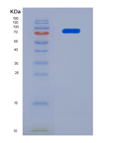 SDS-PAGE analysis of Human TNFRSF21 (Tumor Necrosis Factor Receptor Superfamily Member 21) - Recombinant Protein, CATHuman TNFRSF21 (Tumor Necrosis Factor Receptor Superfamily Member 21) - Recombinant Protein
