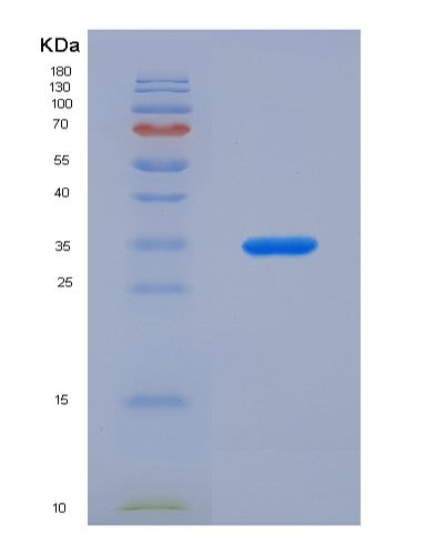 SDS-PAGE analysis of Human CES1 (Liver Carboxylesterase 1) - Recombinant Protein, CATHuman CES1 (Liver Carboxylesterase 1) - Recombinant Protein