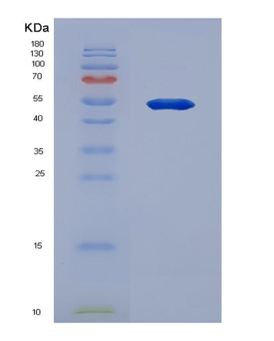 SDS-PAGE analysis of Human SERPINA3 (Alpha-1-Antichymotrypsin) - Recombinant Protein, CAT# BLT-06703P, showing >90% purity under 15% SDS-PAGE (Reduced)Human SERPINA3 (Alpha-1-Antichymotrypsin) - Recombinant Protein
