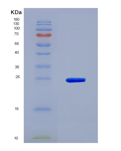 SDS-PAGE analysis of Human FCGR2B (Low Affinity Immunoglobulin Gamma Fc Region Receptor Ii-B) - Recombinant Protein, CATHuman FCGR2B (Low Affinity Immunoglobulin Gamma Fc Region Receptor Ii-B) - Recombinant Protein