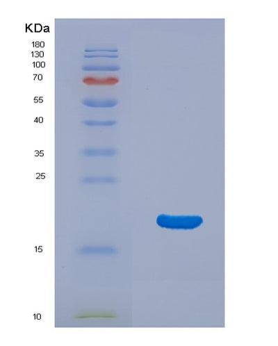 SDS-PAGE analysis of Mouse Il33 (Interleukin-33) - Recombinant Protein, CAT# BLT-07886P, showing >90% purity under 15% SDS-PAGE (Reduced)Mouse Il33 (Interleukin-33) - Recombinant Protein