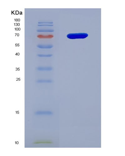 SDS-PAGE analysis of Human CD226 (Cd226 Antigen) - Recombinant Protein, CAT# BLT-06540P, showing >95% purity under 15% SDS-PAGE (Reduced)Human CD226 (Cd226 Antigen) - Recombinant Protein