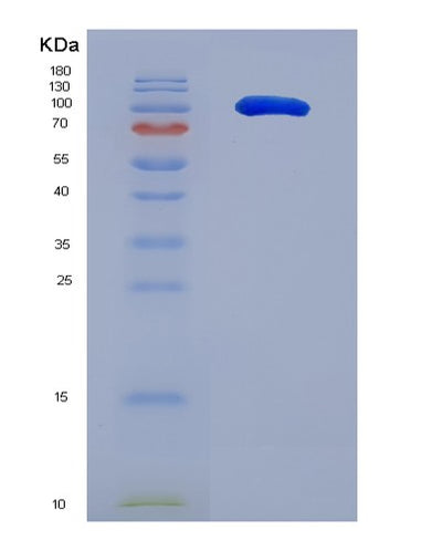 SDS-PAGE analysis of Human ICAM3 (Intercellular Adhesion Molecule 3) - Recombinant Protein, CAT# BLT-05060P, showing >90% purity under 15% SDS-PAGE (Reduced)Human ICAM3 (Intercellular Adhesion Molecule 3) - Recombinant Protein