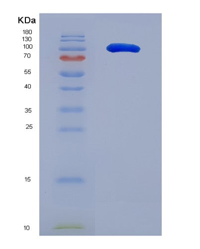 SDS-PAGE analysis of Human ICAM3 (Intercellular Adhesion Molecule 3) - Recombinant Protein, CATHuman ICAM3 (Intercellular Adhesion Molecule 3) - Recombinant Protein