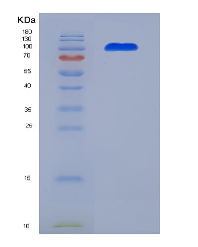 SDS-PAGE analysis of Human CD93 (Complement Component C1Q Receptor) - Recombinant Protein, CAT# BLT-03454P, showing >95% purity under 15% SDS-PAGE (Reduced)Human CD93 (Complement Component C1Q Receptor) - Recombinant Protein