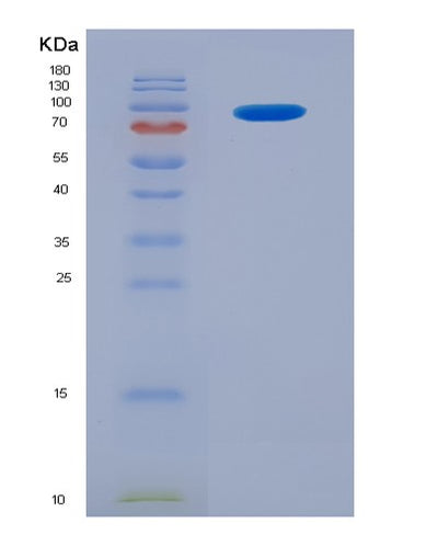 SDS-PAGE analysis of Human SIGLEC5 (Sialic Acid-Binding Ig-Like Lectin 5) - Recombinant Protein, CAT# BLT-06825P, showing >85% purity under 15% SDS-PAGE (Reduced)Human SIGLEC5 (Sialic Acid-Binding Ig-Like Lectin 5) - Recombinant Protein