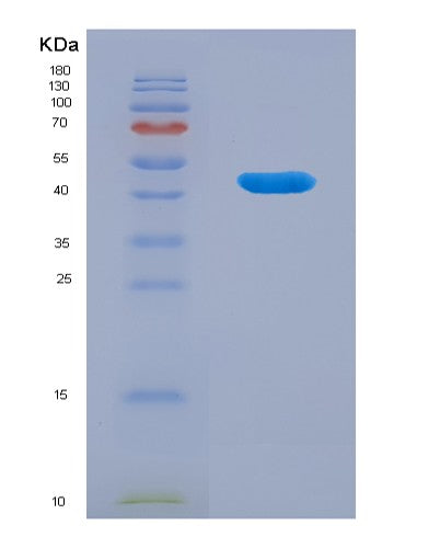 SDS-PAGE analysis of Human CRY1 (Cryptochrome-1) - Recombinant Protein, CATHuman CRY1 (Cryptochrome-1) - Recombinant Protein