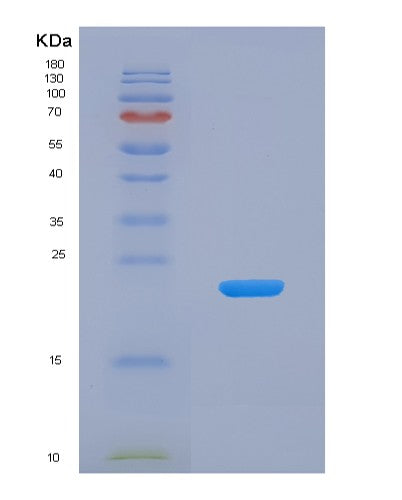 SDS-PAGE analysis of Human KRT9 (Keratin, Type I Cytoskeletal 9) - Recombinant Protein, CATHuman KRT9 (Keratin, Type I Cytoskeletal 9) - Recombinant Protein