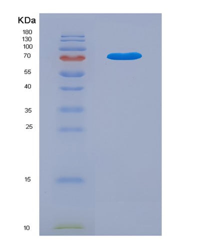 SDS-PAGE analysis of Mouse Lgals3bp (Galectin-3-Binding Protein) - Recombinant Protein, CAT# BLT-07891P, showing >90% purity under 15% SDS-PAGE (Reduced)Mouse Lgals3bp (Galectin-3-Binding Protein) - Recombinant Protein