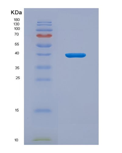 SDS-PAGE analysis of Human CD209 (Cd209 Antigen) - Recombinant Protein, CAT# BLT-07895P, showing >90% purity under 15% SDS-PAGE (Reduced)Human CD209 (Cd209 Antigen) - Recombinant Protein