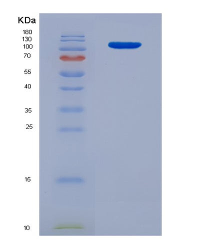 SDS-PAGE analysis of Human SEMA4D (Semaphorin-4D) - Recombinant Protein, CAT# BLT-03981P, showing >85% purity under 15% SDS-PAGE (Reduced)Human SEMA4D (Semaphorin-4D) - Recombinant Protein