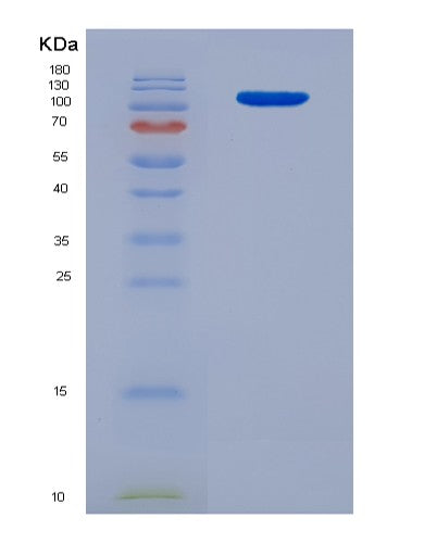 SDS-PAGE analysis of Human SEMA4D (Semaphorin-4D) - Recombinant Protein, CATHuman SEMA4D (Semaphorin-4D) - Recombinant Protein