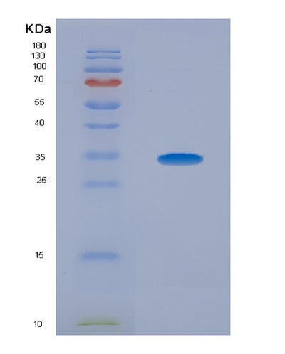 SDS-PAGE analysis of Human NOG (Noggin) - Recombinant Protein, CAT# BLT-04054P, showing >90% purity under 15% SDS-PAGE (Reduced)Human NOG (Noggin) - Recombinant Protein