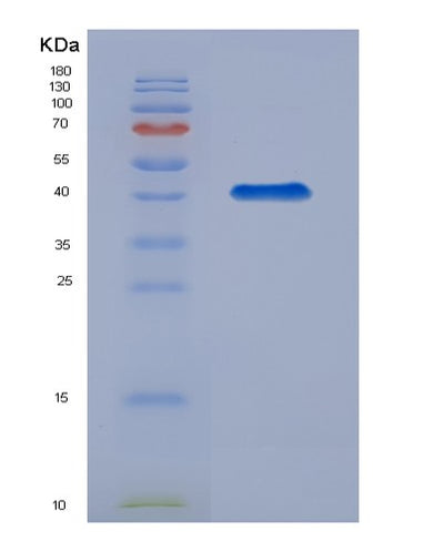 SDS-PAGE analysis of Human BCAN (Brevican Core Protein) - Recombinant Protein, CAT# BLT-07897P, showing >90% purity under 15% SDS-PAGE (Reduced)Human BCAN (Brevican Core Protein) - Recombinant Protein