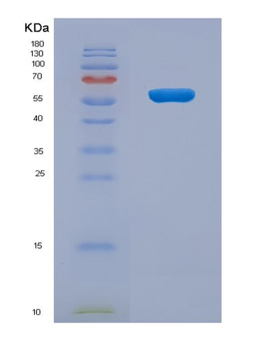 SDS-PAGE analysis of Human KLRB1 (Killer Cell Lectin-Like Receptor Subfamily B Member 1) - Recombinant Protein, CAT# BLT-04778P, showing >85% purity under 15% SDS-PAGE (Reduced)Human KLRB1 (Killer Cell Lectin-Like Receptor Subfamily B Member 1) - Recombinant Protein