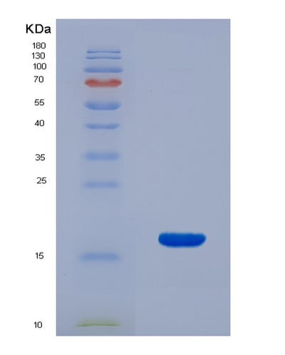 SDS-PAGE analysis of Mouse Fgf10 (Fibroblast Growth Factor 10) - Recombinant Protein, CAT# BLT-07899P, showing >90% purity under 15% SDS-PAGE (Reduced)Mouse Fgf10 (Fibroblast Growth Factor 10) - Recombinant Protein