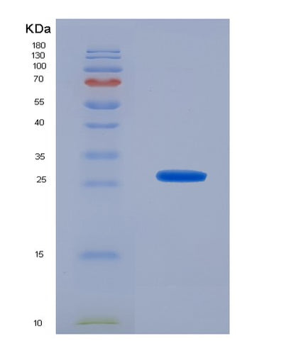 SDS-PAGE analysis of Mouse Cd40lg (Cd40 Ligand) - Recombinant Protein, CAT# BLT-07902P, showing >90% purity under 15% SDS-PAGE (Reduced)Mouse Cd40lg (Cd40 Ligand) - Recombinant Protein