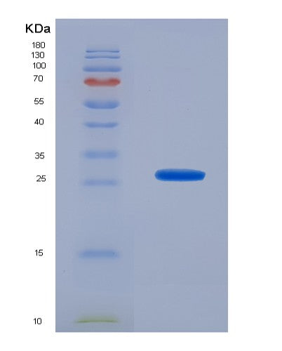 SDS-PAGE analysis of Mouse Cd40lg (Cd40 Ligand) - Recombinant Protein, CATMouse Cd40lg (Cd40 Ligand) - Recombinant Protein
