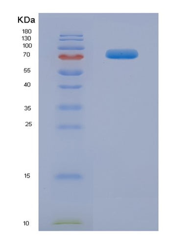 SDS-PAGE analysis of Human IL23R (Interleukin-23 Receptor) - Recombinant Protein, CAT# BLT-03850P, showing >90% purity under 15% SDS-PAGE (Reduced)Human IL23R (Interleukin-23 Receptor) - Recombinant Protein