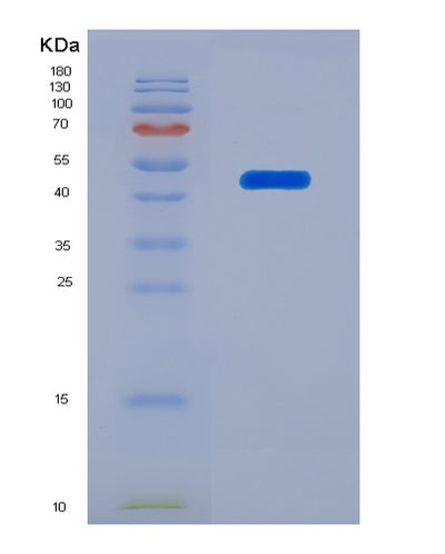 SDS-PAGE analysis of Human MICB (Mhc Class I Polypeptide-Related Sequence B) - Recombinant Protein, CAT# BLT-06403P, showing >95% purity under 15% SDS-PAGE (Reduced)Human MICB (Mhc Class I Polypeptide-Related Sequence B) - Recombinant Protein