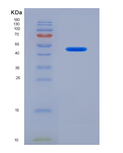 SDS-PAGE analysis of Human SIGLEC7 (Sialic Acid-Binding Ig-Like Lectin 7) - Recombinant Protein, CATHuman SIGLEC7 (Sialic Acid-Binding Ig-Like Lectin 7) - Recombinant Protein