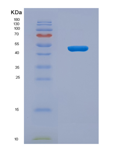 SDS-PAGE analysis of Human NSUN5 (28S Rrna (Cytosine-C(5))-Methyltransferase) - Recombinant Protein, CAT# BLT-07905P, showing >90% purity under 15% SDS-PAGE (Reduced)Human NSUN5 (28S Rrna (Cytosine-C(5))-Methyltransferase) - Recombinant Protein