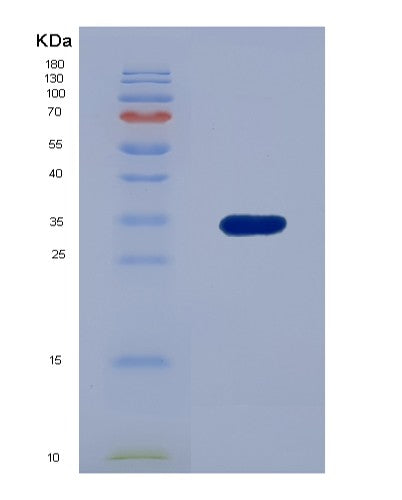 SDS-PAGE analysis of Human HSD11B1 (11-Beta-Hydroxysteroid Dehydrogenase 1) - Recombinant Protein, CATHuman HSD11B1 (11-Beta-Hydroxysteroid Dehydrogenase 1) - Recombinant Protein