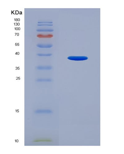SDS-PAGE analysis of Human SFRP4 (Secreted Frizzled-Related Protein 4) - Recombinant Protein, CAT# BLT-07908P, showing >90% purity under 15% SDS-PAGE (Reduced)Human SFRP4 (Secreted Frizzled-Related Protein 4) - Recombinant Protein