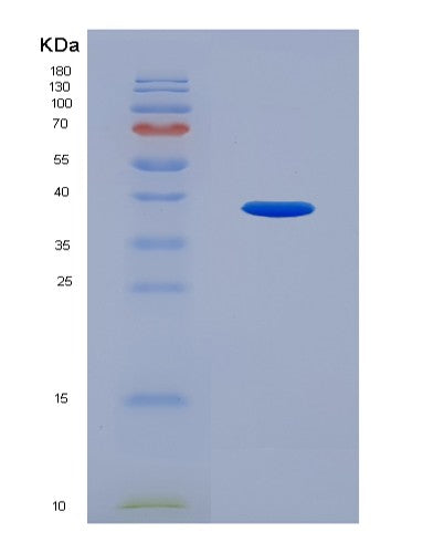 SDS-PAGE analysis of Human SFRP4 (Secreted Frizzled-Related Protein 4) - Recombinant Protein, CATHuman SFRP4 (Secreted Frizzled-Related Protein 4) - Recombinant Protein