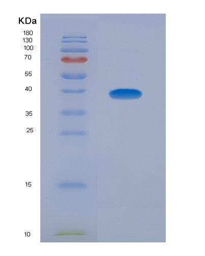 SDS-PAGE analysis of Human SLAMF1 (Signaling Lymphocytic Activation Molecule) - Recombinant Protein, CATHuman SLAMF1 (Signaling Lymphocytic Activation Molecule) - Recombinant Protein