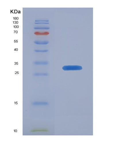 SDS-PAGE analysis of Human C1QA (Complement C1Q Subcomponent Subunit A) - Recombinant Protein, CAT# BLT-07912P, showing >90% purity under 15% SDS-PAGE (Reduced)Human C1QA (Complement C1Q Subcomponent Subunit A) - Recombinant Protein
