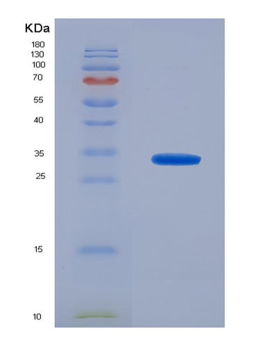 SDS-PAGE analysis of Human SLC25A13 (Electrogenic Aspartate/Glutamate Antiporter Slc25A13, Mitochondrial) - Recombinant Protein, CAT# BLT-07913P, showing >90% purity under 15% SDS-PAGE (Reduced)Human SLC25A13 (Electrogenic Aspartate/Glutamate Antiporter Slc25A13, Mitochondrial) - Recombinant Protein