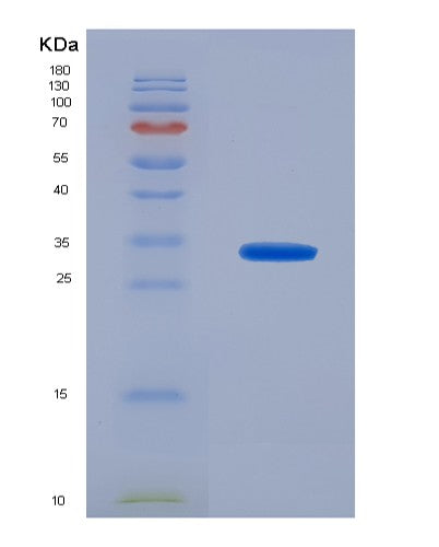 SDS-PAGE analysis of Human SLC25A13 (Electrogenic Aspartate/Glutamate Antiporter Slc25A13, Mitochondrial) - Recombinant Protein, CATHuman SLC25A13 (Electrogenic Aspartate/Glutamate Antiporter Slc25A13, Mitochondrial) - Recombinant Protein
