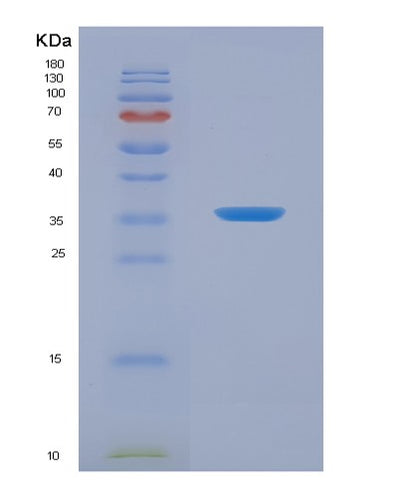 SDS-PAGE analysis of Human COX4I1 (Cytochrome C Oxidase Subunit 4 Isoform 1, Mitochondrial) - Recombinant Protein, CAT# BLT-07914P, showing >90% purity under 15% SDS-PAGE (Reduced)Human COX4I1 (Cytochrome C Oxidase Subunit 4 Isoform 1, Mitochondrial) - Recombinant Protein