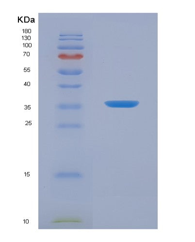 SDS-PAGE analysis of Human COX4I1 (Cytochrome C Oxidase Subunit 4 Isoform 1, Mitochondrial) - Recombinant Protein, CATHuman COX4I1 (Cytochrome C Oxidase Subunit 4 Isoform 1, Mitochondrial) - Recombinant Protein