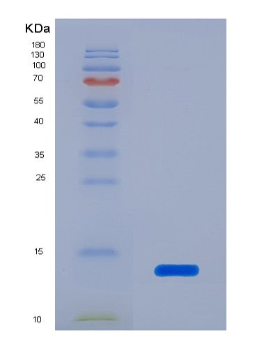 SDS-PAGE analysis of Human LAMTOR5 (Ragulator Complex Protein Lamtor5) - Recombinant Protein, CATHuman LAMTOR5 (Ragulator Complex Protein Lamtor5) - Recombinant Protein