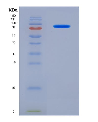 SDS-PAGE analysis of Human SERPING1 (Plasma Protease C1 Inhibitor) - Recombinant Protein, CAT# BLT-04318P, showing >95% purity under 15% SDS-PAGE (Reduced)Human SERPING1 (Plasma Protease C1 Inhibitor) - Recombinant Protein