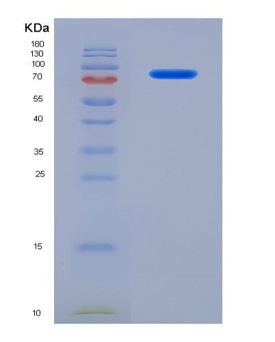 SDS-PAGE analysis of Human SERPING1 (Plasma Protease C1 Inhibitor) - Recombinant Protein, CATHuman SERPING1 (Plasma Protease C1 Inhibitor) - Recombinant Protein