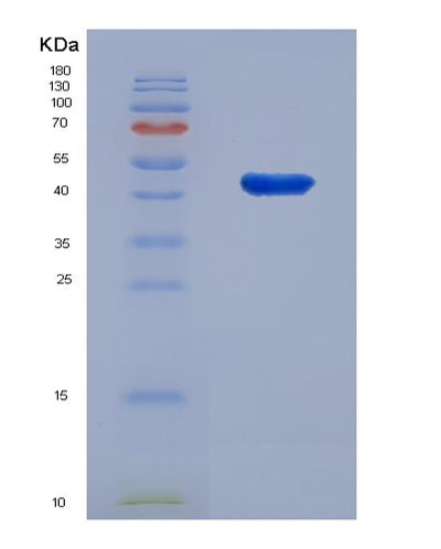 SDS-PAGE analysis of Human IL18RAP (Interleukin-18 Receptor Accessory Protein) - Recombinant Protein, CAT# BLT-05200P, showing >95% purity under 15% SDS-PAGE (Reduced)Human IL18RAP (Interleukin-18 Receptor Accessory Protein) - Recombinant Protein