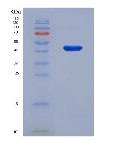 SDS-PAGE analysis of Human IL18RAP (Interleukin-18 Receptor Accessory Protein) - Recombinant Protein, CATHuman IL18RAP (Interleukin-18 Receptor Accessory Protein) - Recombinant Protein