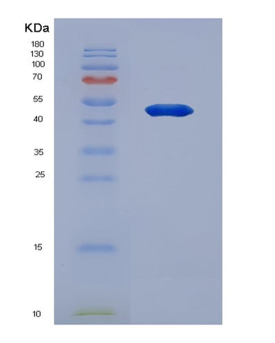 SDS-PAGE analysis of Human DSG3 (Desmoglein-3) - Recombinant Protein, CAT# BLT-07871P, showing >90% purity under 15% SDS-PAGE (Reduced)Human DSG3 (Desmoglein-3) - Recombinant Protein