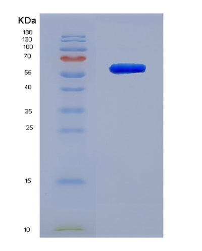 SDS-PAGE analysis of Human DSG1 (Desmoglein-1) - Recombinant Protein, CAT# BLT-07918P, showing >90% purity under 15% SDS-PAGE (Reduced)Human DSG1 (Desmoglein-1) - Recombinant Protein