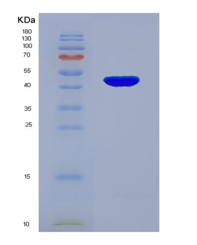 SDS-PAGE analysis of Human IL12B (Interleukin-12 Subunit Beta) - Recombinant Protein, CAT# BLT-04096P, showing >90% purity under 15% SDS-PAGE (Reduced)Human IL12B (Interleukin-12 Subunit Beta) - Recombinant Protein