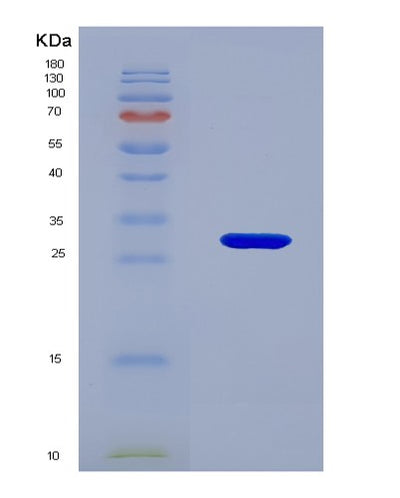 SDS-PAGE analysis of Mouse Vegfa (Vascular Endothelial Growth Factor A, Long Form) - Recombinant Protein, CAT# BLT-07921P, showing >90% purity under 15% SDS-PAGE (Reduced)Mouse Vegfa (Vascular Endothelial Growth Factor A, Long Form) - Recombinant Protein