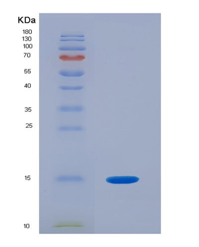 SDS-PAGE analysis of Mouse Il21 (Interleukin-21) - Recombinant Protein, CAT# BLT-07923P, showing >90% purity under 15% SDS-PAGE (Reduced)Mouse Il21 (Interleukin-21) - Recombinant Protein