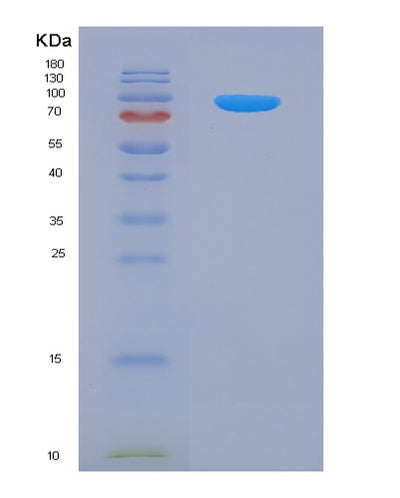 SDS-PAGE analysis of Human APP (Amyloid-Beta Precursor Protein) - Recombinant Protein, CAT# BLT-07924P, showing >90% purity under 15% SDS-PAGE (Reduced)Human APP (Amyloid-Beta Precursor Protein) - Recombinant Protein