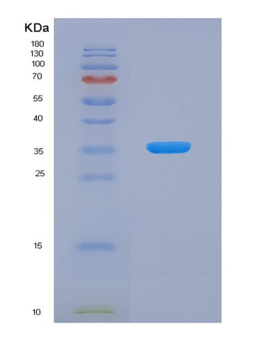 SDS-PAGE analysis of Human FHL1 (Four And A Half Lim Domains Protein 1) - Recombinant Protein, CAT# BLT-07925P, showing >90% purity under 15% SDS-PAGE (Reduced)Human FHL1 (Four And A Half Lim Domains Protein 1) - Recombinant Protein